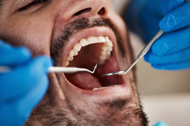 Best Emergency Root Canal Therapy in Crownsville, MD